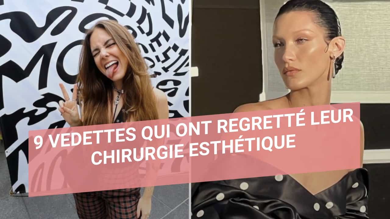 9 vedettes qui ont regretté leur chirurgie esthétique