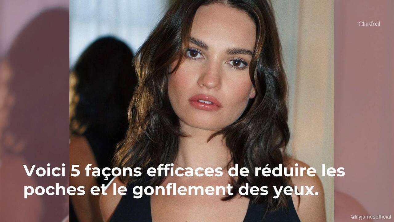 5 façons de vaincre les poches et le gonflement du contour des yeux