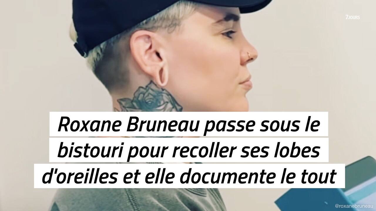 Roxane Bruneau passe sous le bistouri pour recoller ses lobes d'oreilles et elle documente le tout