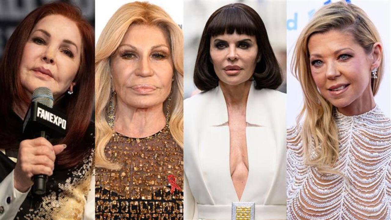 31 célébrités qui ont abusé de la chirurgie plastique