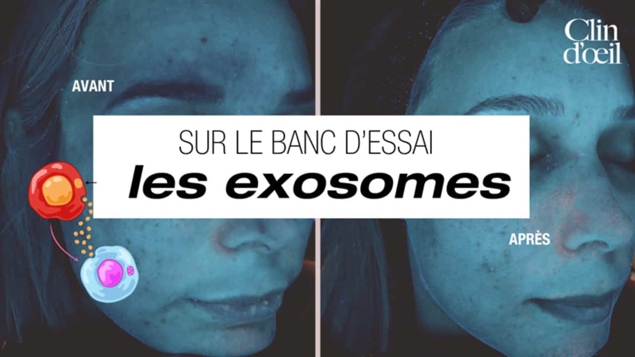 [VIDÉO] J'ai testé les exosomes, le traitement viral des stars